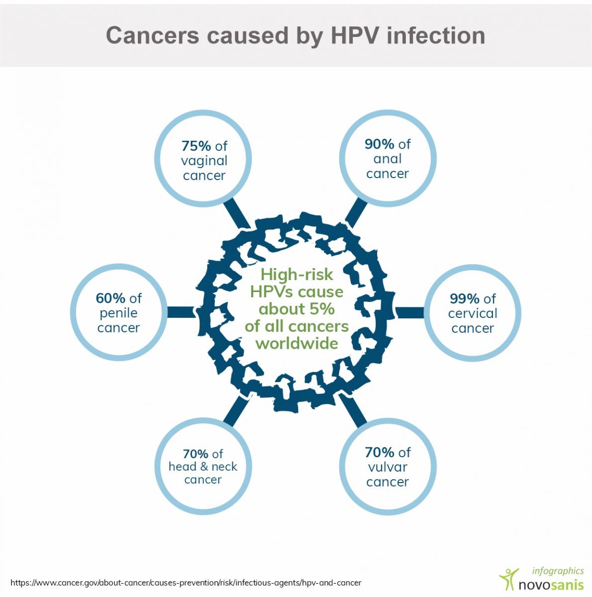 Cancers caused by HPV infection (infographic)