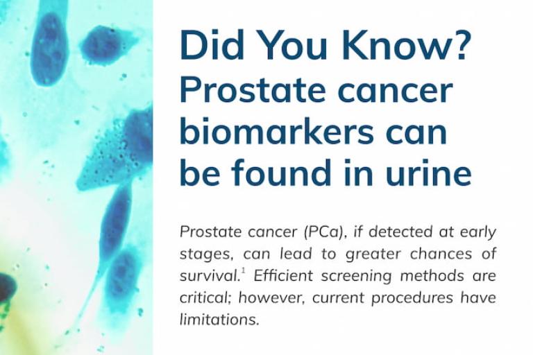 Prostate cancer biomarkers facts (infographic)
