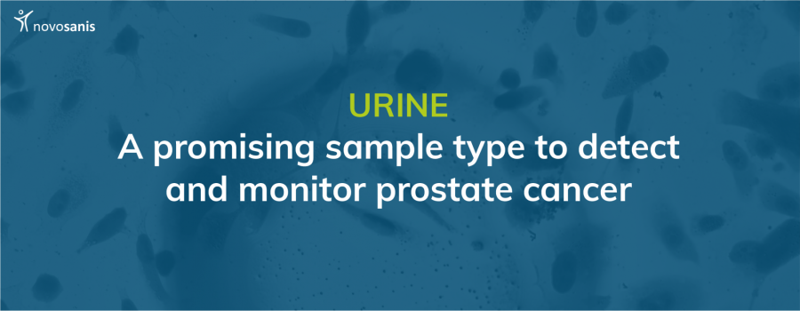 Urine: a promising sample type to detect and monitor prostate cancer