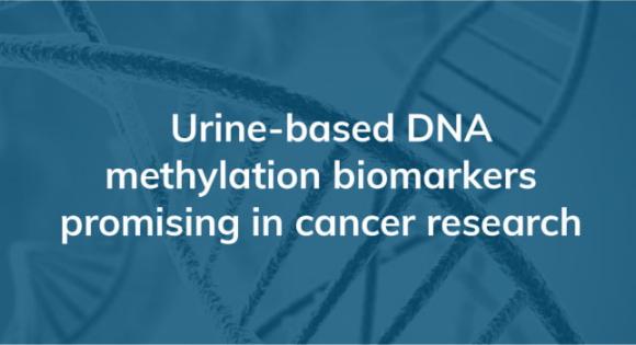 Urine-based DNA methylation biomarkers promising in cancer research
