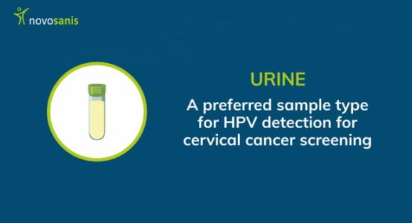Urine: a preferred sample type for HPV detection