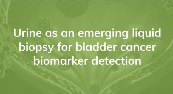 Urine as an emerging liquid biopsy for bladder cancer biomarker detection