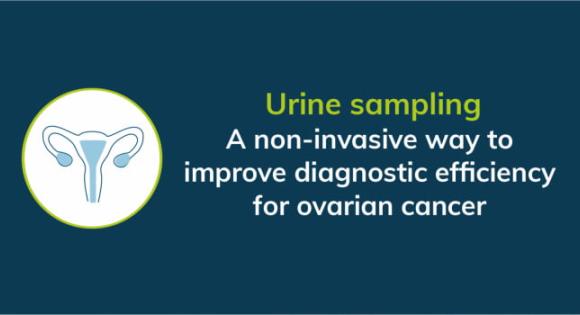 Urine sampling: A non-invasive way to improve diagnostic efficiency for ovarian cancer